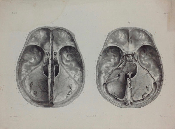 L'Anatomie de L'Homme, Dure-mère encéphalique