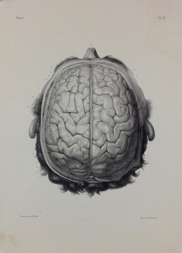 L'Anatomie de L'Homme, Cerveaux
