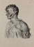 J.M. Bourgery, N.H. Jacob   L'Anatomie de L'Homme, Saignée des Veines Jugulaire et Céphalique