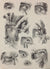 J.M. Bourgery, N.H. Jacob   L'Anatomie de L'Homme, Opérations curatives de la blépharoptose et de l'ectropion