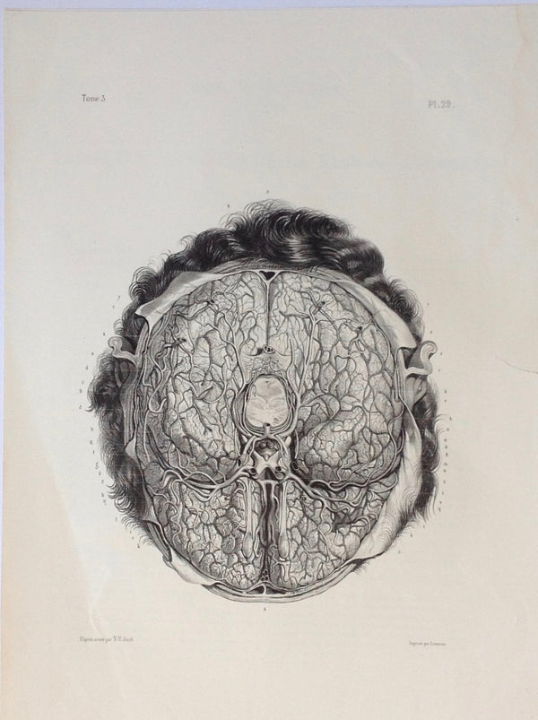 J.M. Bourgery, N.H. Jacob    L'Anatomie de L'Homme, Vaisseaux sanguins de la base cerveau